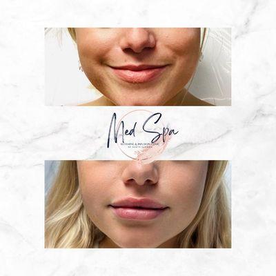 Ketamine Clinic of South Florida