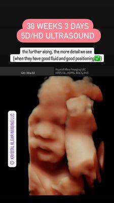 Krystal Klear Imaging