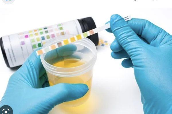 DOT and Non Dot urine Specimen