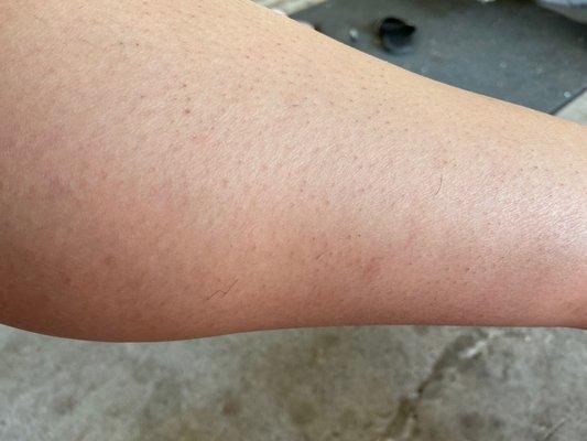 Ultimate Image MedSpa