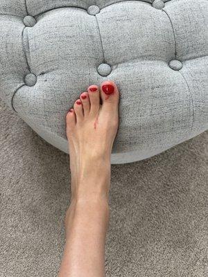Thursday morning, still bleeding on and off. Pedicure on Tuesday.