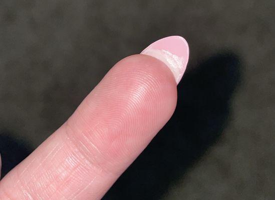 this is after i scrubbed underneath my nails