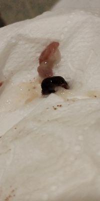 What causes this my bowel movements are like this but way more usually should I be worried