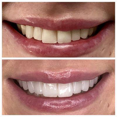 Palani Center For Dental Implants