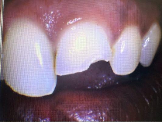 Hilltop Family Dental