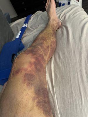 Total Joint Specialists