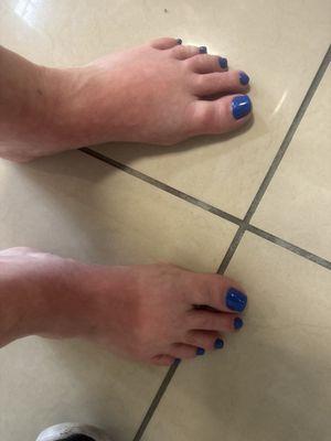 Toe nails and acrylic gel nails