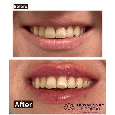 Hennessay Medical Direct Primary Care