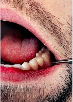 Westview Dental Care