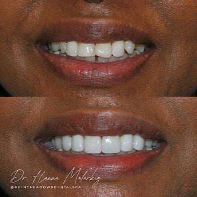 Point Meadows Dentistry