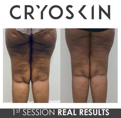 Physioflow Physical Therapy & Cryoskin