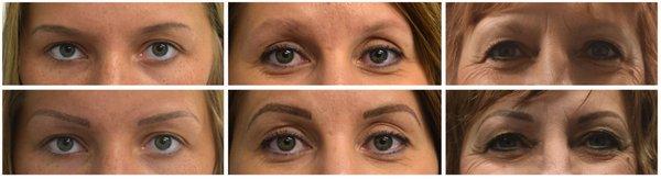 Permanent Cosmetic Solutions