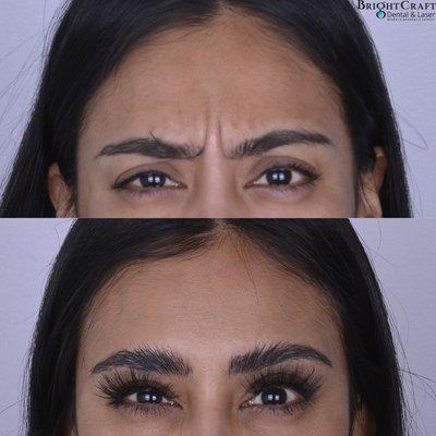 Brightcraft Med Spa in Burbank