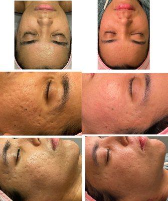 K Beauty Skin Clinic