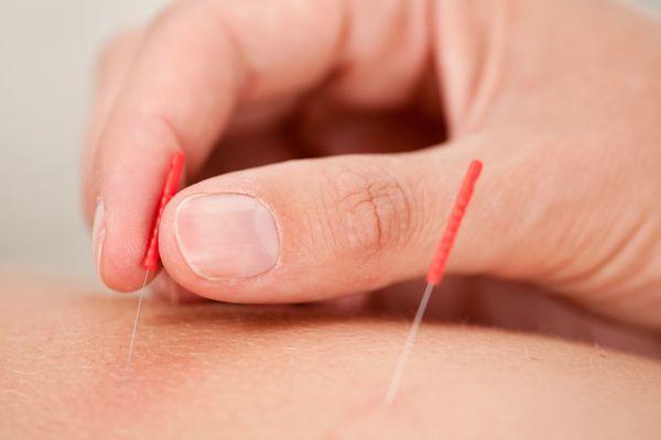 Susana Byers Acupuncture