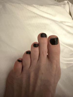 Terrible pedicure fresh from the salon.