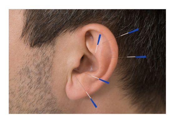 German Village Acupuncture