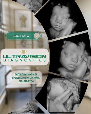 Ultravision Diagnostics