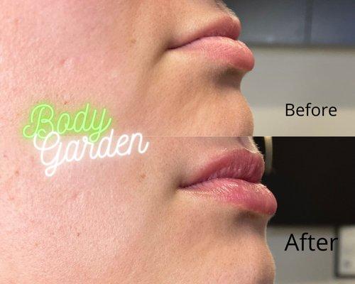 BodyGarden