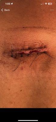 Siva Mullangi, MD, FACS