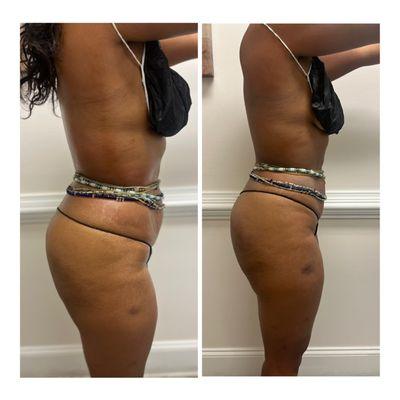 Heavy on The 8 Shape