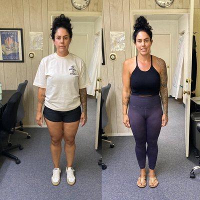 Salem S. lost 17 lbs in 6 weeks in spite of Hypothyroidism