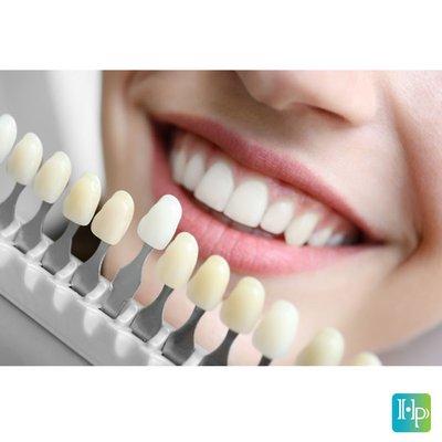 Get the best missing teeth treatment in Kearny, NJ at Hudson Park Dental.