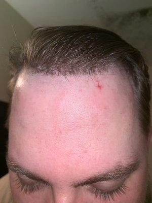 I don't know who taught this guy to cut hair but they must have been blind