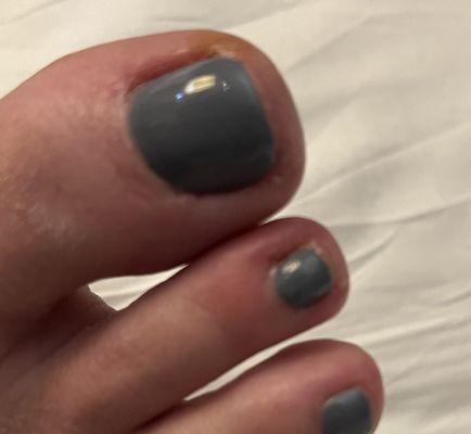 Edges of these two toes were cut too deeply