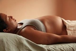 Prenatal acupuncture