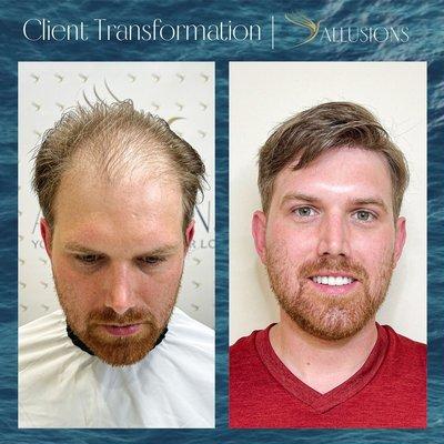 Allusions Hair Replacement Studio