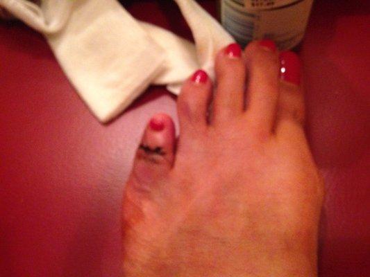 Michael A. Klein, D.p.m. A.b.f.a.s