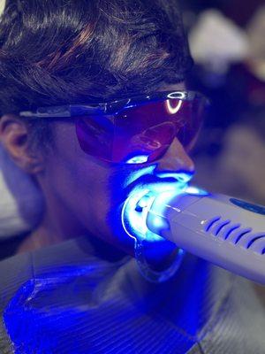 30-minute teeth whitening treatment. Great service if you need just a quick touch-up 90 days after initial treatment.