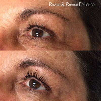 Revive & Renew Esthetics