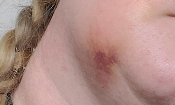 Affordable Dentures & Implants