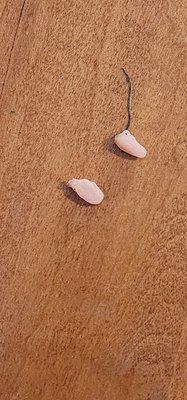 Impression material sutured in my brother's mouth after extractions