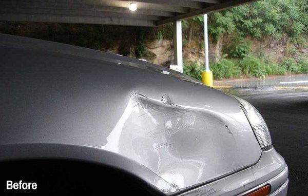 Dent FX