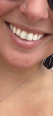 Pittsford Dental Excellence Center