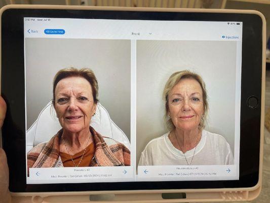 Mountain View Aesthetics