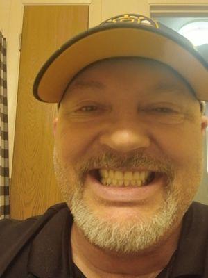 I'm able to smile now with confidence.