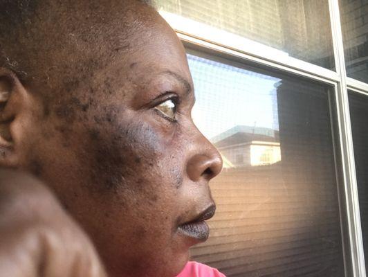 The right side of my face