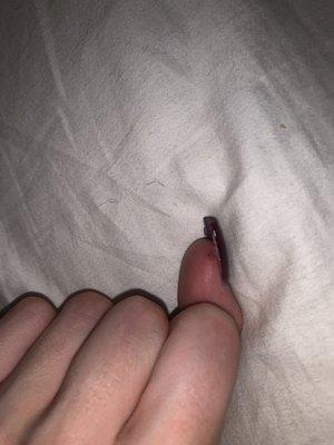 one of the many (surprisingly painful) battle scars