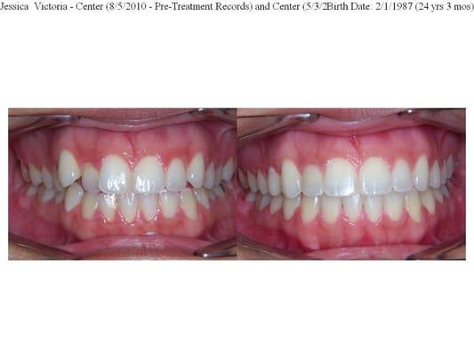 Quintero Orthodontics