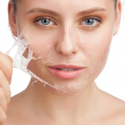 Chemical peel for overall rejuvenation