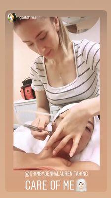 Microdermabrasion Treatment