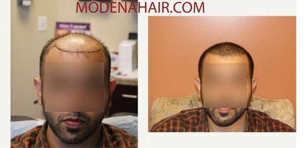 Modena Hair Institute