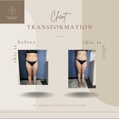 Embodyment Sculpting