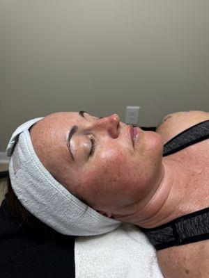 Anti aging facial