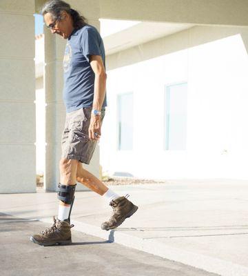 Prosthetic Center of Excellence