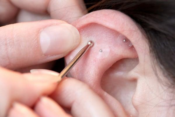 Acupressure seeds for the ear keep stress, anxiety and tension away.